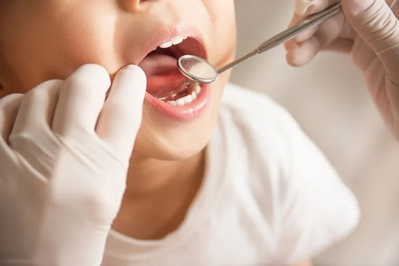 健全な歯の発達を見守る小児歯科